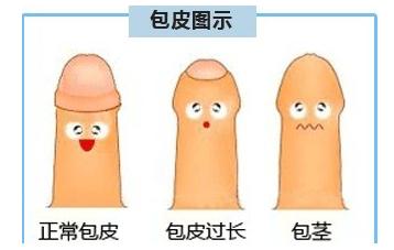 男性包皮过长的危害有哪些