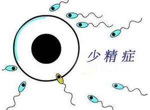 怎么预防死精