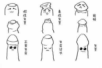 包皮过长怎么治疗